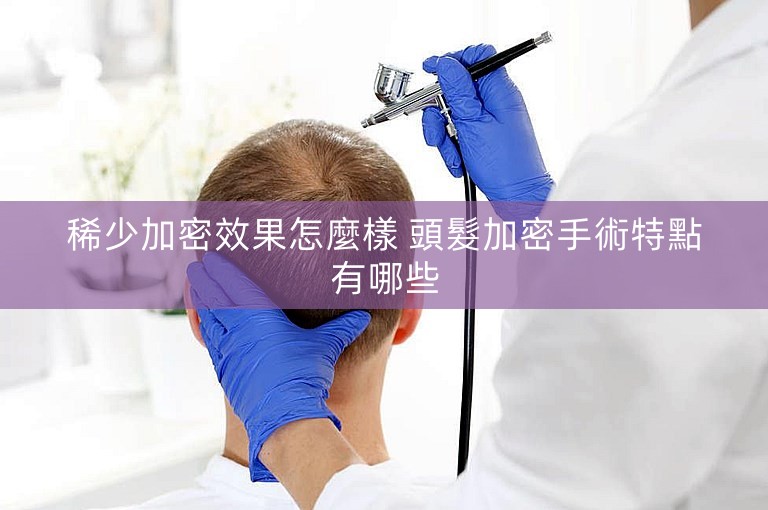 稀少加密效果怎麼樣 頭髮加密手術特點有哪些