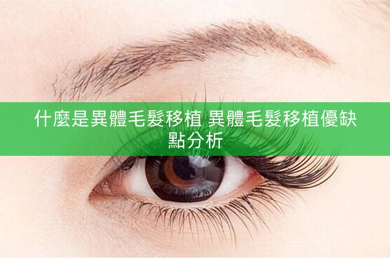 什麼是異體毛髮移植 異體毛髮移植優缺點分析 什麼是異體毛髮移植 異體毛髮移植優缺點分析
