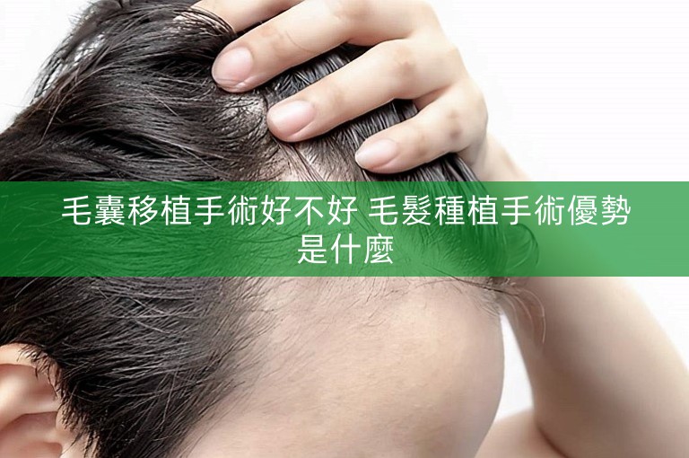 毛囊移植手術好不好 毛髮種植手術優勢是什麼