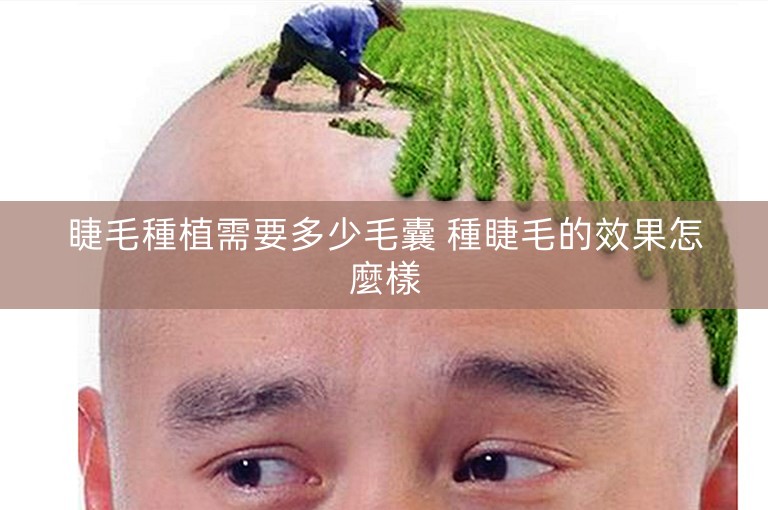 睫毛種植需要多少毛囊 種睫毛的效果怎麼樣