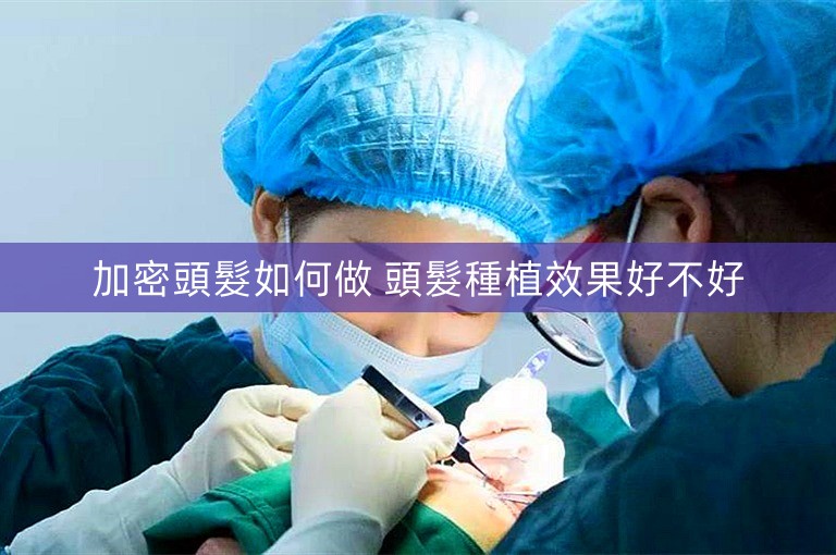 加密頭髮如何做 頭髮種植效果好不好