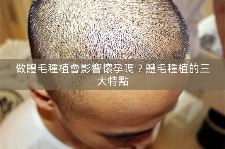 做體毛種植會影響懷孕嗎?體毛種植的三大特點 做體毛種植會影響懷孕嗎?體毛種植的三大特點