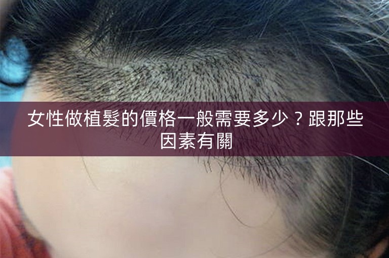 女性做植髮的價格一般需要多少？跟那些因素有關