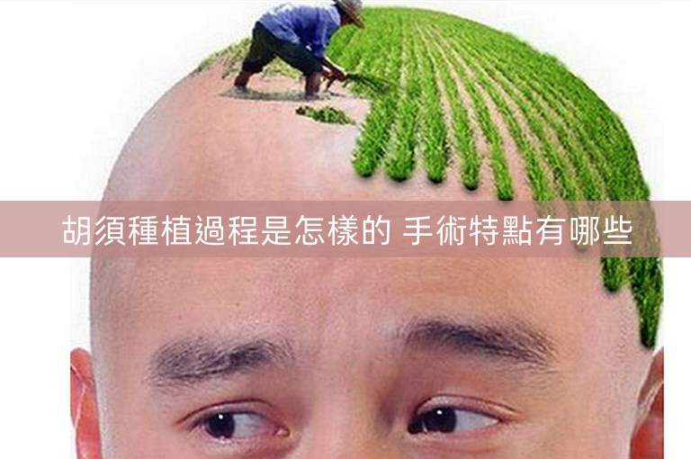 胡須種植過程是怎樣的 手術特點有哪些