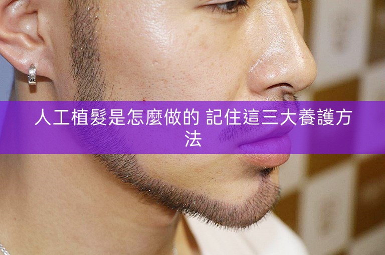 人工植髮是怎麼做的 記住這三大養護方法