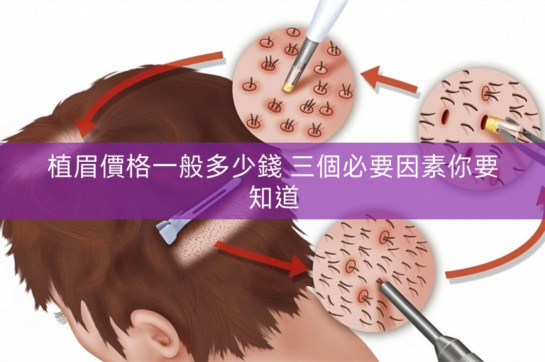 植眉價格一般多少錢 三個必要因素你要知道