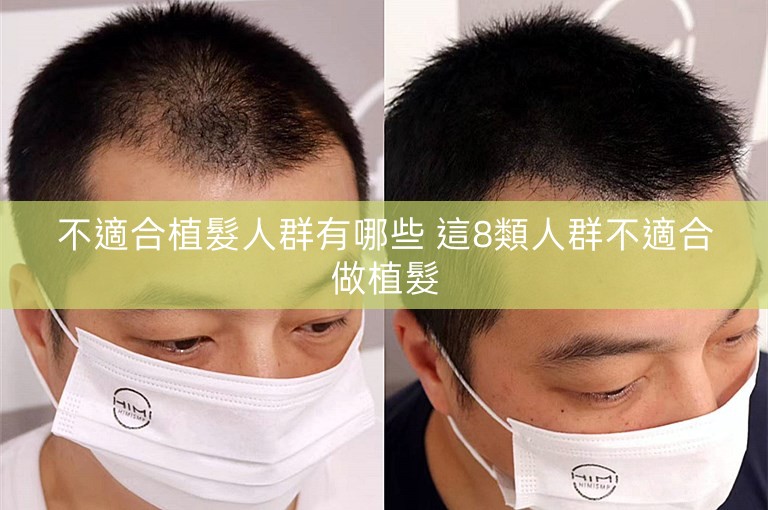 不適合植髮人群有哪些 這8類人群不適合做植髮 不適合植髮人群有哪些 這8類人群不適合做植髮