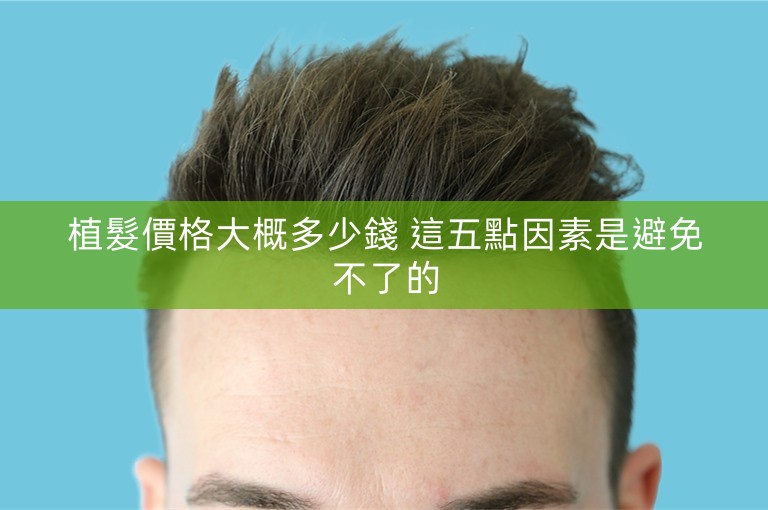 植髮價格大概多少錢 這五點因素是避免不了的