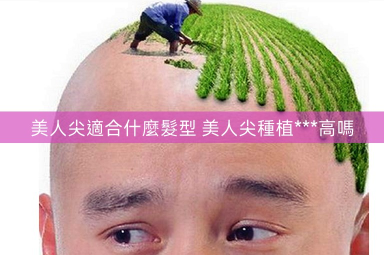 美人尖適合什麼髮型 美人尖種植***高嗎