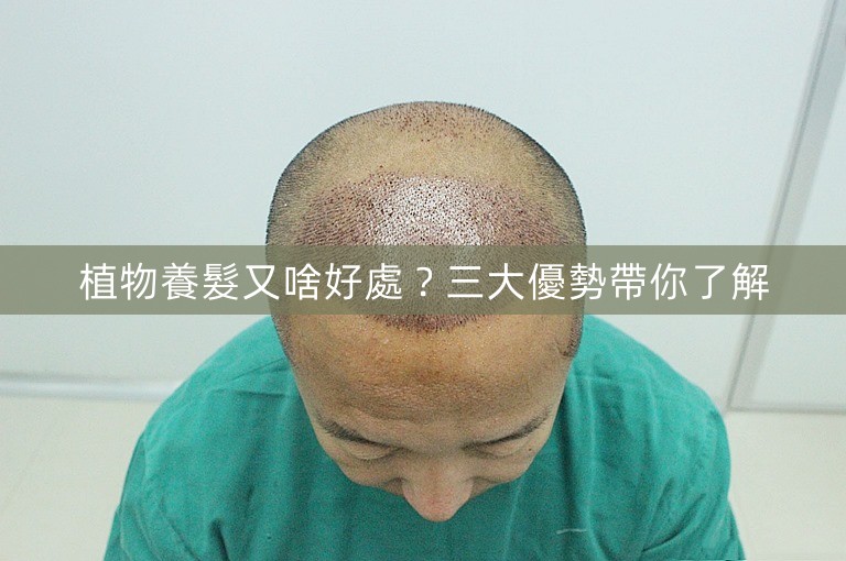 植物養髮又啥好處?三大優勢帶你了解 植物養髮又啥好處?三大優勢帶你了解