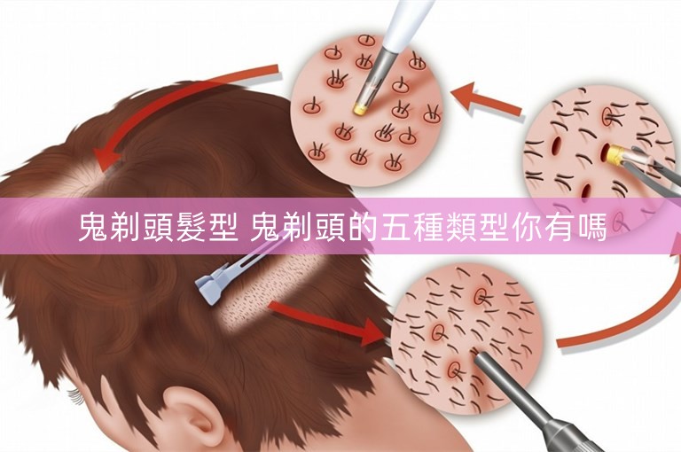 鬼剃頭髮型 鬼剃頭的五種類型你有嗎