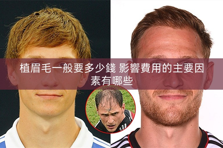 植眉毛一般要多少錢 影響費用的主要因素有哪些 植眉毛一般要多少錢 影響費用的主要因素有哪些