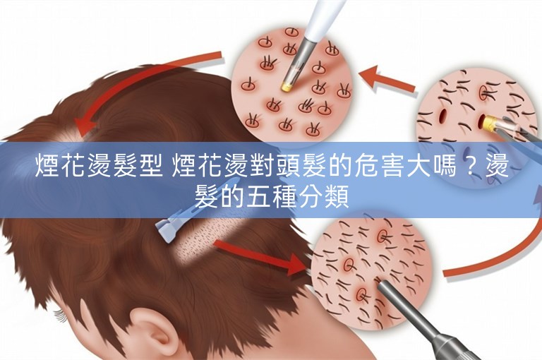 煙花燙髮型 煙花燙對頭髮的危害大嗎？燙髮的五種分類