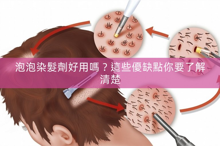 泡泡染髮劑好用嗎？這些優缺點你要了解清楚