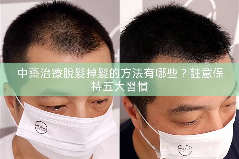 中藥治療脫髮掉髮的方法有哪些？註意保持五大習慣