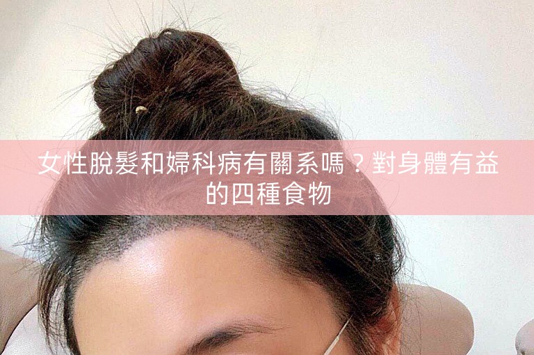 女性脫髮和婦科病有關系嗎？對身體有益的四種食物