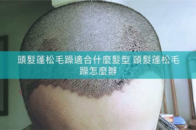 頭髮蓬松毛躁適合什麼髮型 頭髮蓬松毛躁怎麼辦