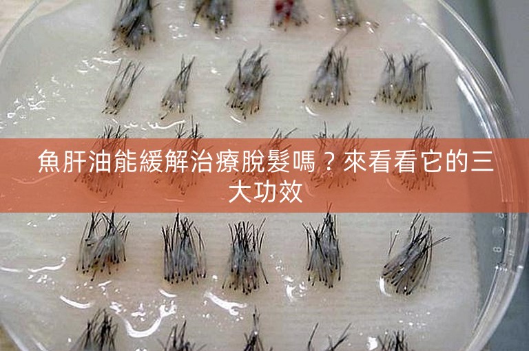 魚肝油能緩解治療脫髮嗎？來看看它的三大功效