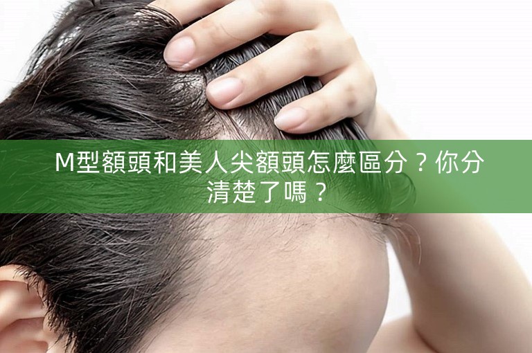  M型額頭和美人尖額頭怎麼區分？你分清楚了嗎？