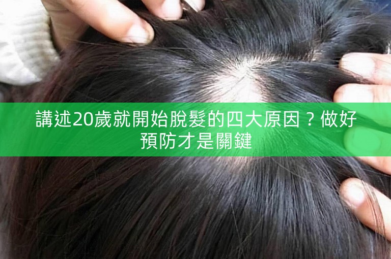 講述20歲就開始脫髮的四大原因？做好預防才是關鍵