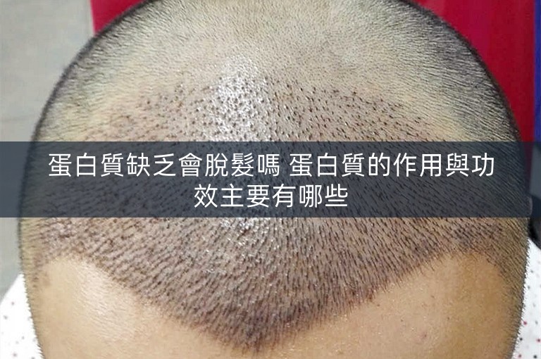 蛋白質缺乏會脫髮嗎 蛋白質的作用與功效主要有哪些