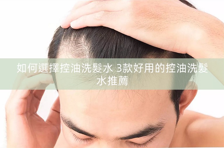如何選擇控油洗髮水 3款好用的控油洗髮水推薦