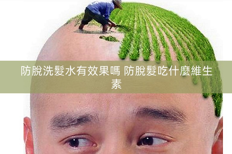 防脫洗髮水有效果嗎 防脫髮吃什麼維生素