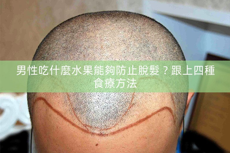 男性吃什麼水果能夠防止脫髮？跟上四種食療方法