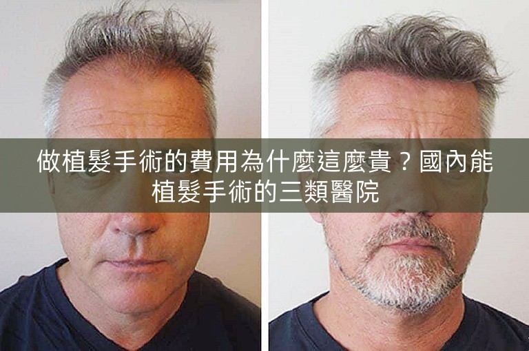 做植髮手術的費用為什麼這麼貴？國內能植髮手術的三類醫院