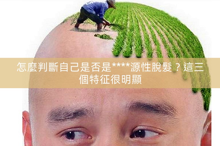 怎麼判斷自己是否是****源性脫髮？這三個特征很明顯