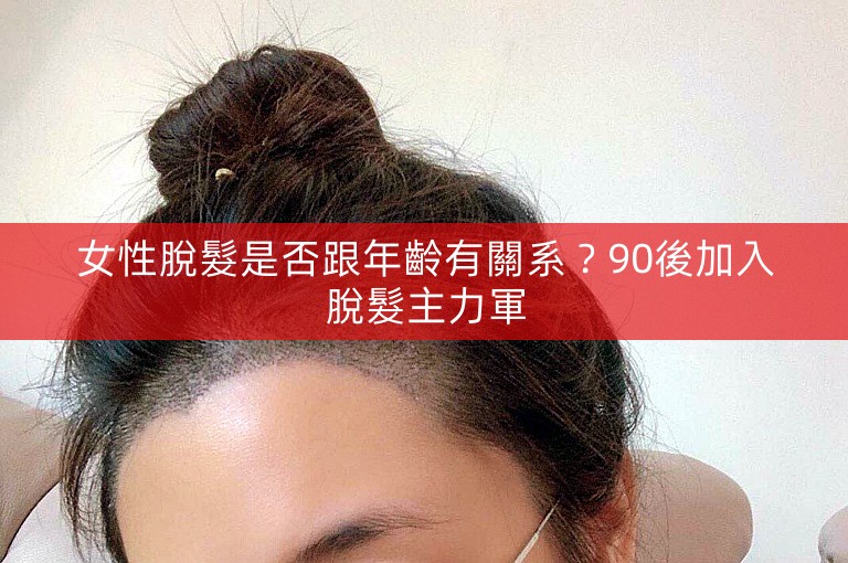 女性脫髮是否跟年齡有關系？90後加入脫髮主力軍