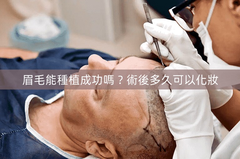 眉毛能種植成功嗎？術後多久可以化妝