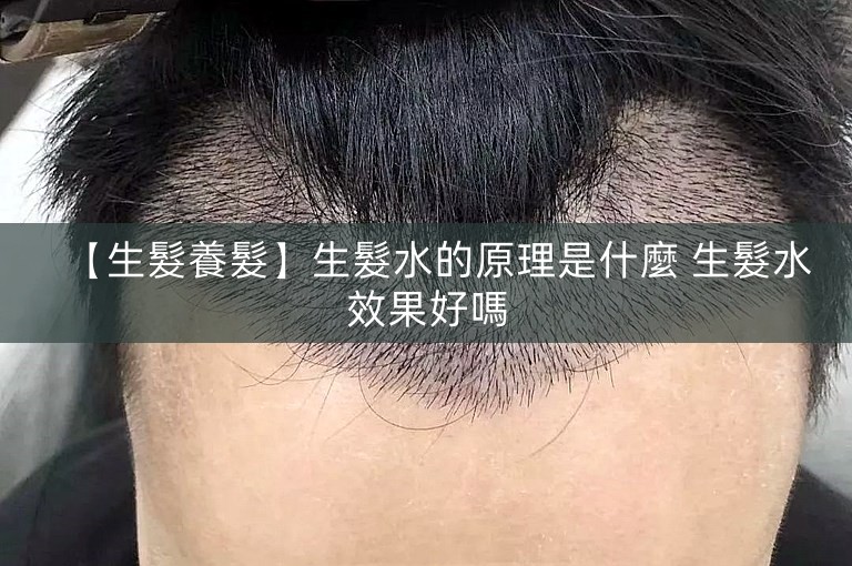 【生髮養髮】生髮水的原理是什麼 生髮水效果好嗎 【生髮養髮】生髮水的原理是什麼 生髮水效果好嗎