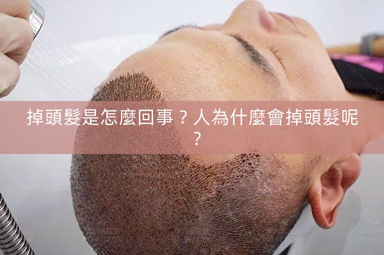 掉頭髮是怎麼回事?人為什麼會掉頭髮呢? 掉頭髮是怎麼回事?人為什麼會掉頭髮呢?