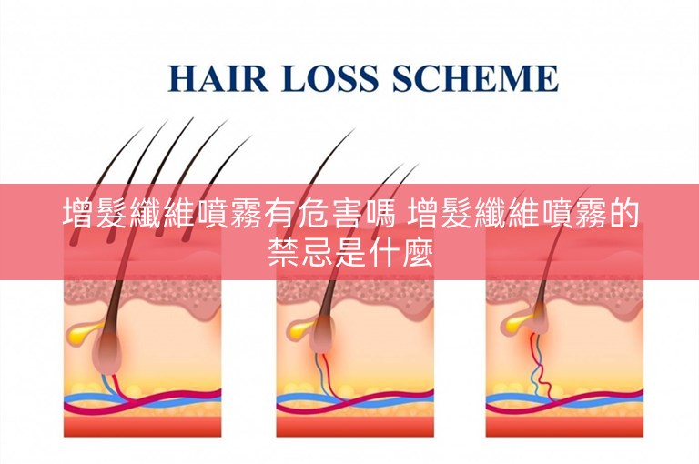 增髮纖維噴霧有危害嗎 增髮纖維噴霧的禁忌是什麼