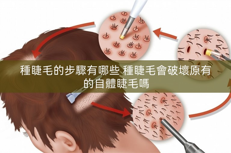 種睫毛的步驟有哪些 種睫毛會破壞原有的自體睫毛嗎