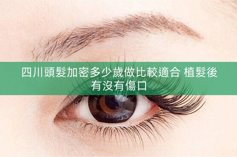 四川頭髮加密多少歲做比較適合 植髮後有沒有傷口