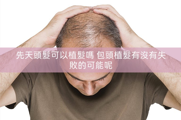 先天頭髮可以植髮嗎 包頭植髮有沒有失敗的可能呢 先天頭髮可以植髮嗎 包頭植髮有沒有失敗的可能呢