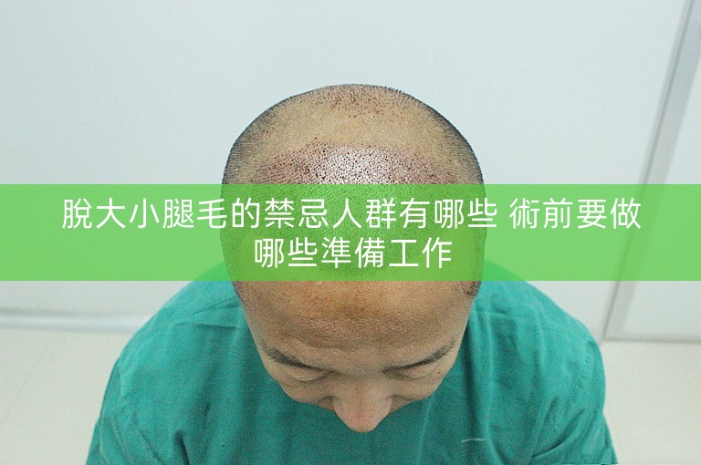 脫大小腿毛的禁忌人群有哪些 術前要做哪些準備工作