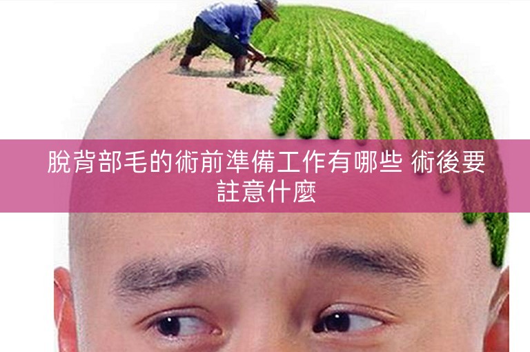 脫背部毛的術前準備工作有哪些 術後要註意什麼