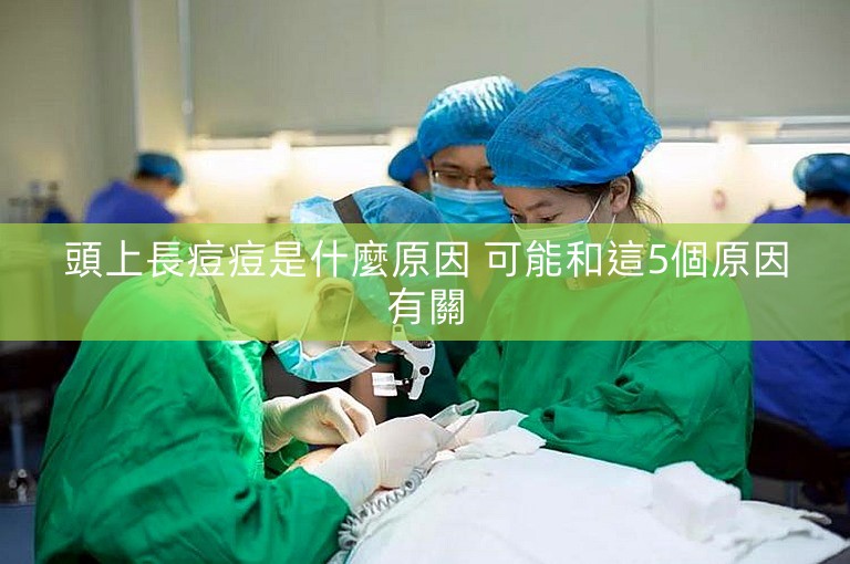 頭上長痘痘是什麼原因 可能和這5個原因有關 頭上長痘痘是什麼原因 可能和這5個原因有關