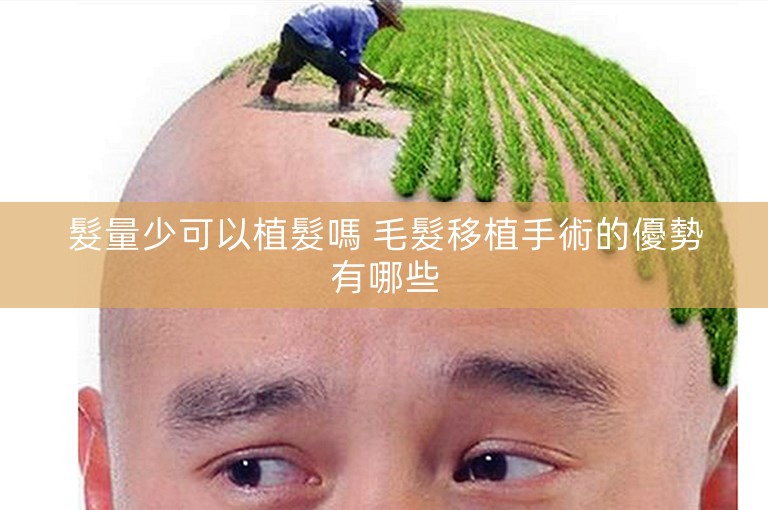 髮量少可以植髮嗎 毛髮移植手術的優勢有哪些