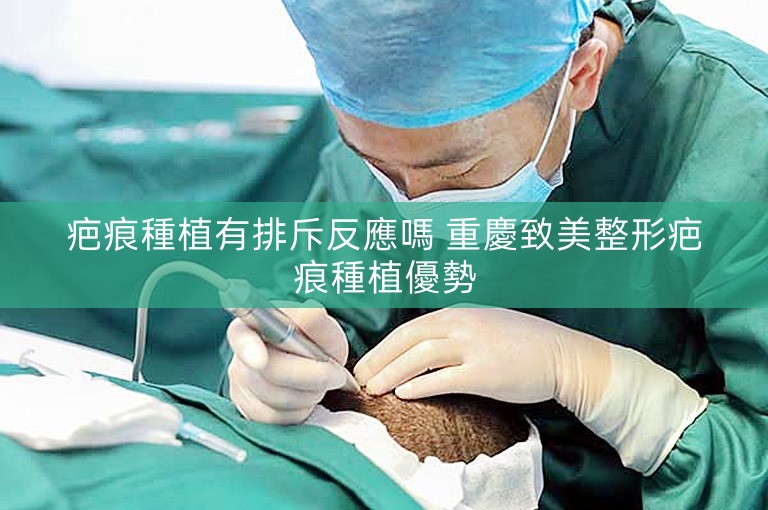 疤痕種植有排斥反應嗎 重慶致美整形疤痕種植優勢 疤痕種植有排斥反應嗎 重慶致美整形疤痕種植優勢