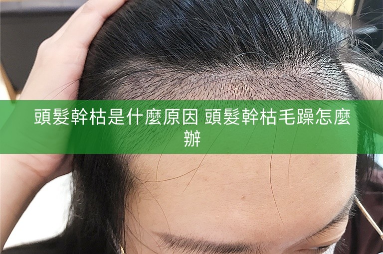 頭髮幹枯是什麼原因 頭髮幹枯毛躁怎麼辦