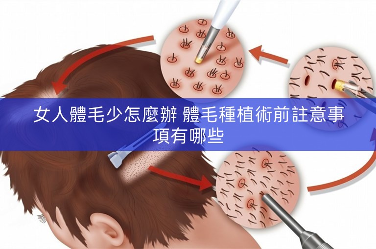 女人體毛少怎麼辦 體毛種植術前註意事項有哪些