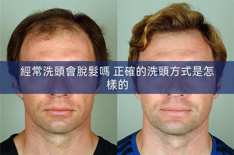 經常洗頭會脫髮嗎 正確的洗頭方式是怎樣的 經常洗頭會脫髮嗎 正確的洗頭方式是怎樣的