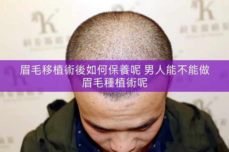 眉毛移植術後如何保養呢 男人能不能做眉毛種植術呢