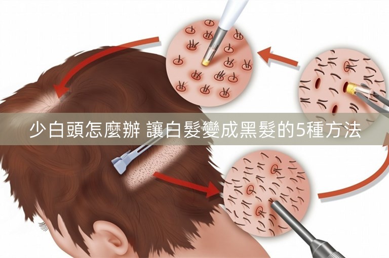 少白頭怎麼辦 讓白髮變成黑髮的5種方法