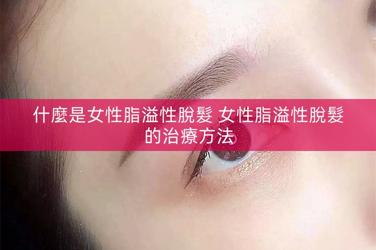 什麼是女性脂溢性脫髮 女性脂溢性脫髮的治療方法