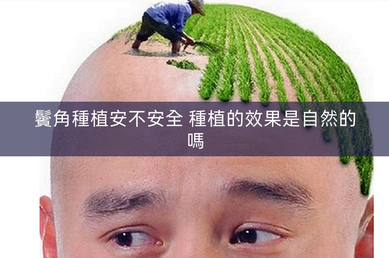 鬢角種植安不安全 種植的效果是自然的嗎